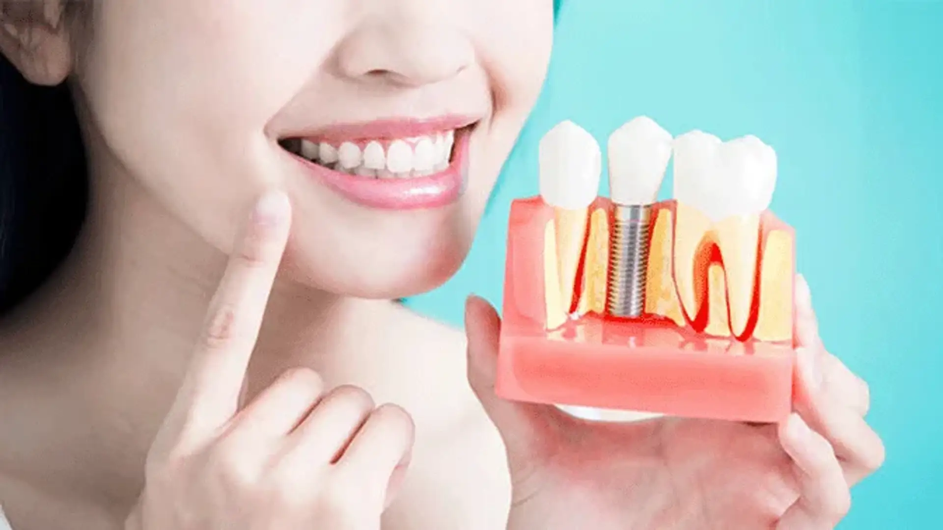 care-following-dental-implant