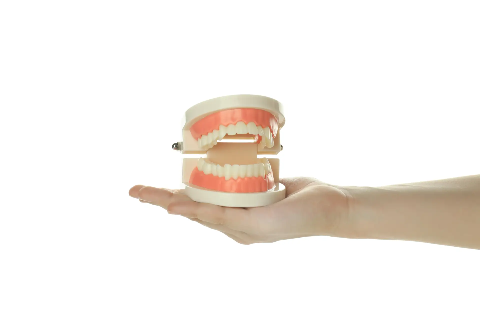 implant-supported-dentures