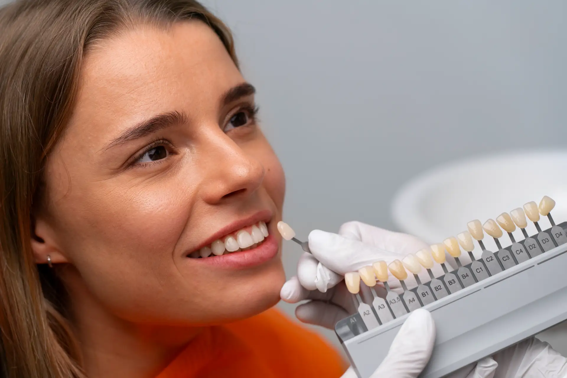 caring-your-e-max-veneers