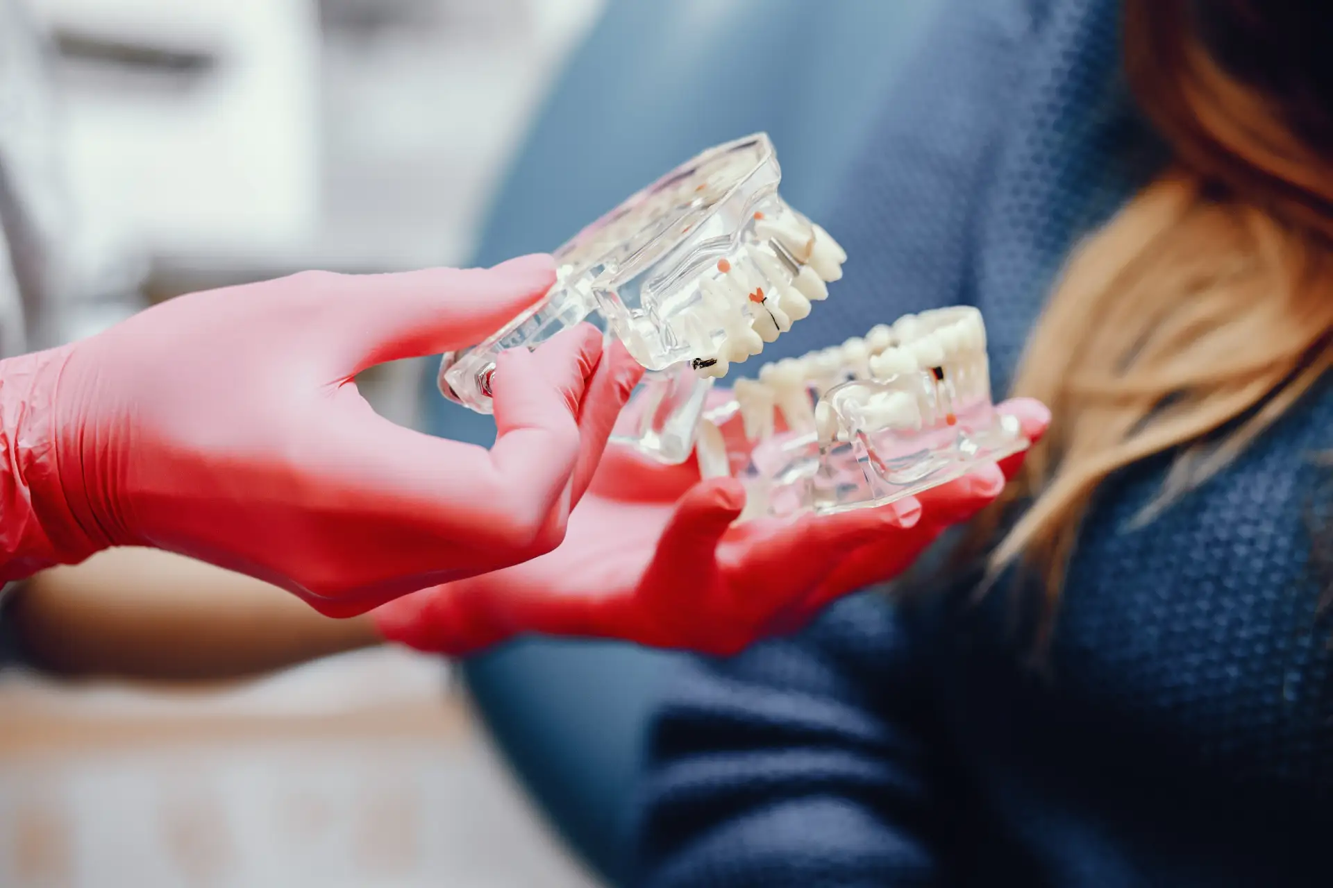 immediate-load-implants