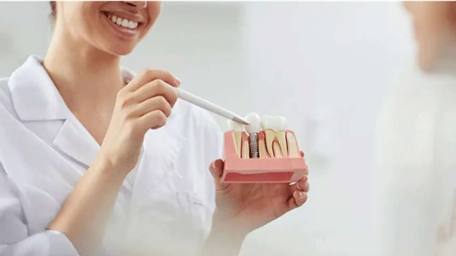 healing-after-dental-implant