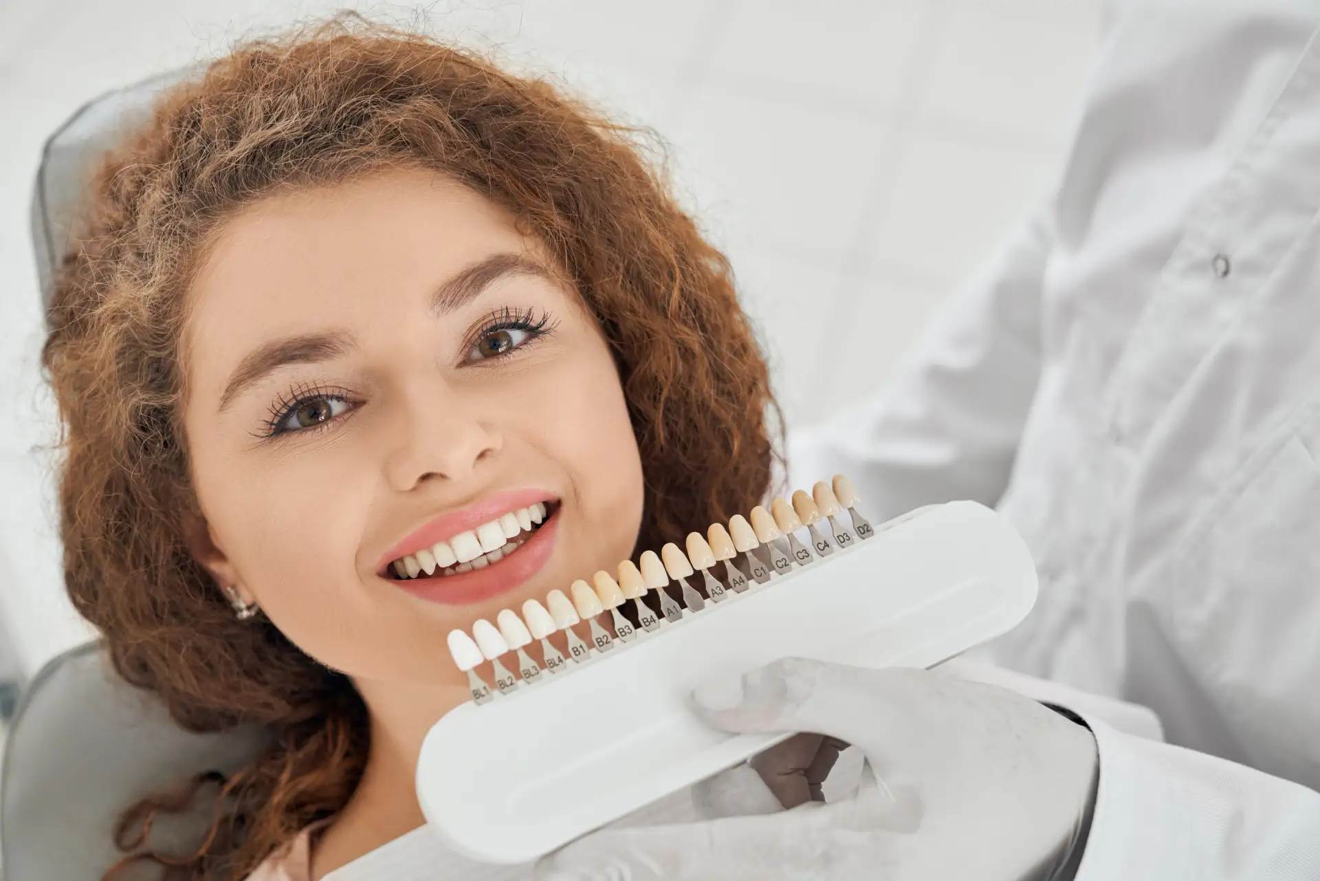what-are-e-max-veneers