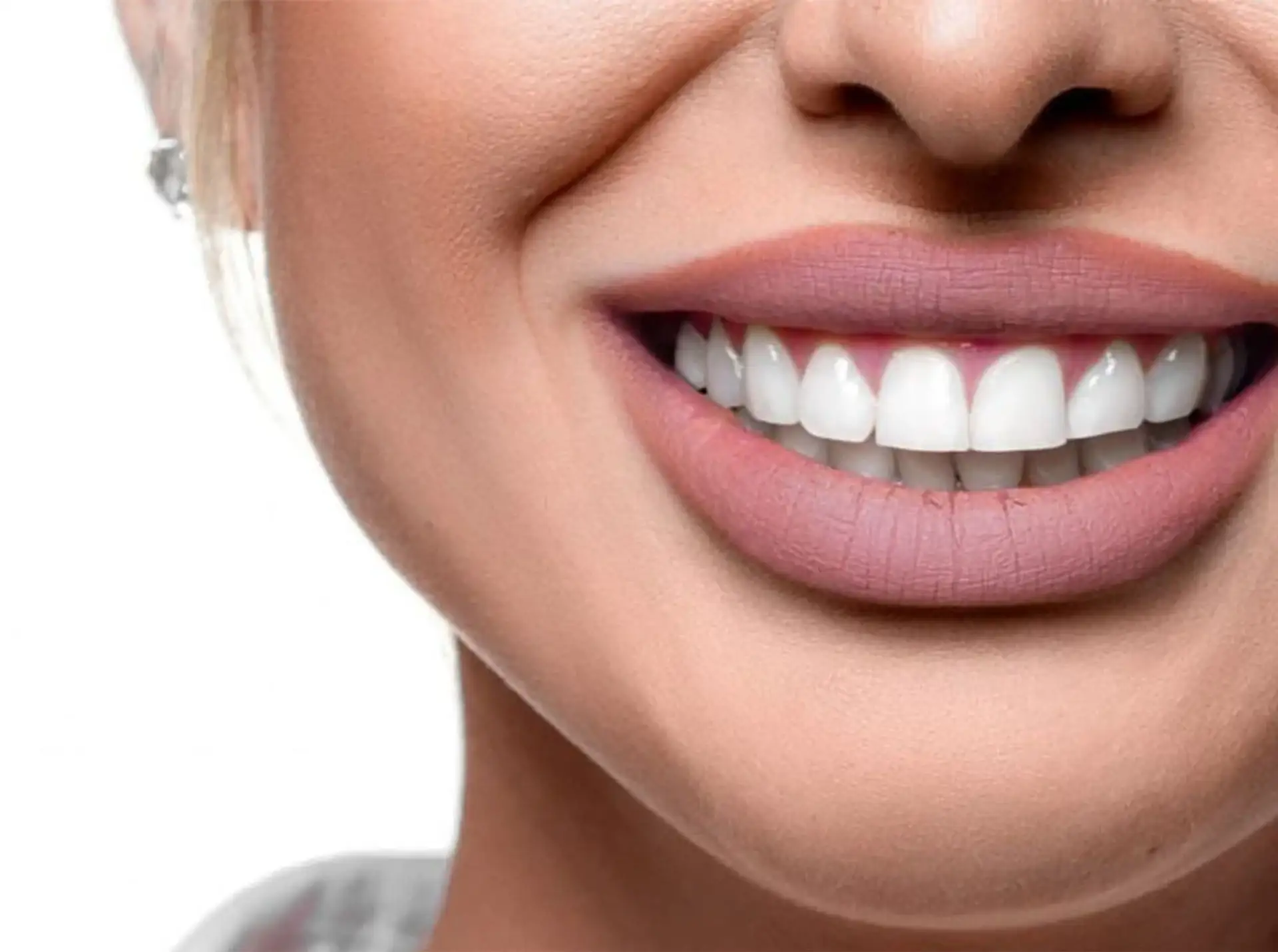 what-type-dental-implant