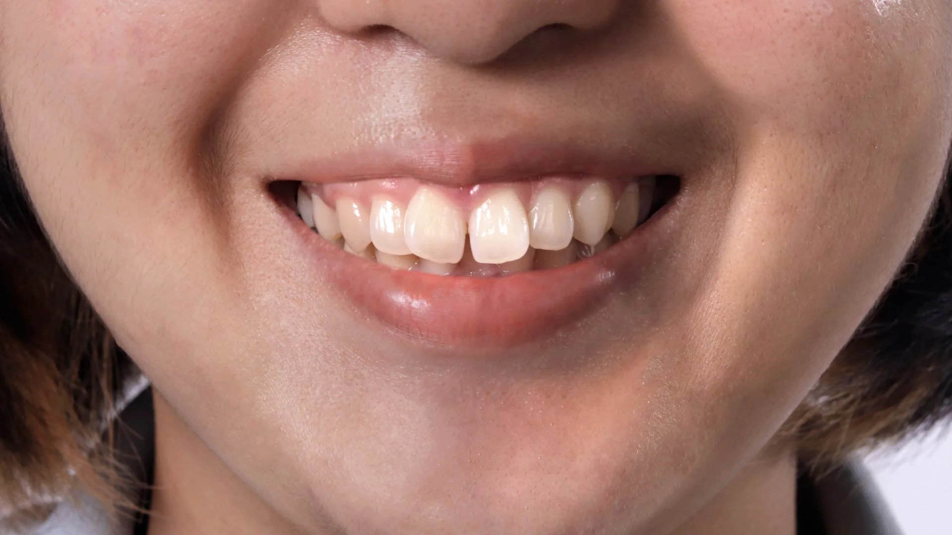Buck Teeth .jpg